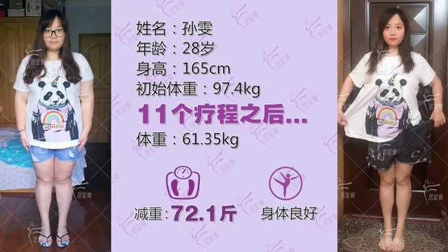 孙雯小仙女在居家瘦成功减重72.1斤