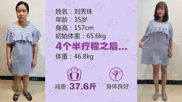 刘秀珠小仙女在居家瘦成功减重37.6斤