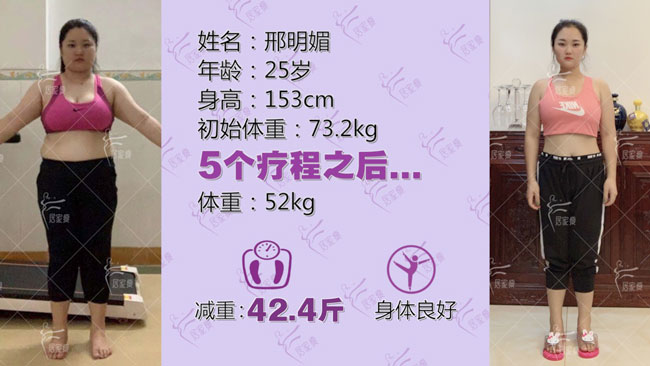 邢明媚小仙女在居家瘦成功减重42.4斤