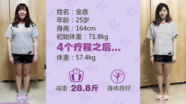 金鑫小仙女在居家瘦成功减重28.8斤