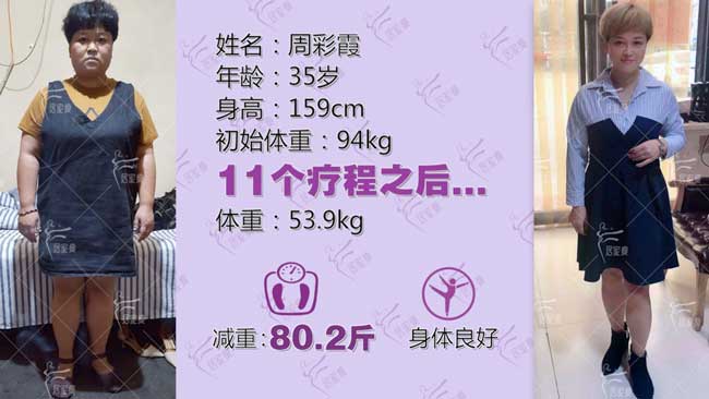 周彩霞小仙女在居家瘦成功减重80.2斤