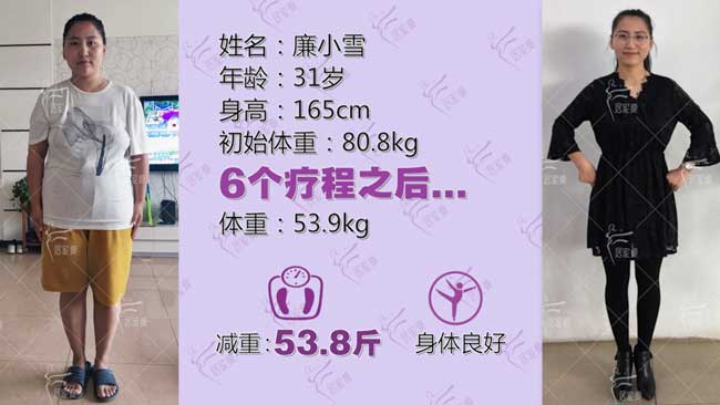廉小雪小仙女在居家瘦成功减重53.8斤