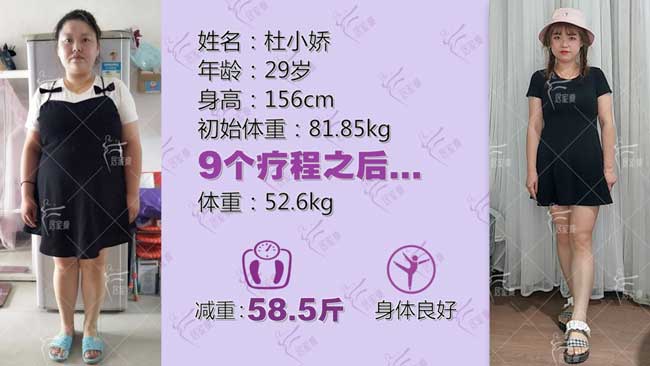 杜小娇小仙女在居家瘦成功减重58.5斤