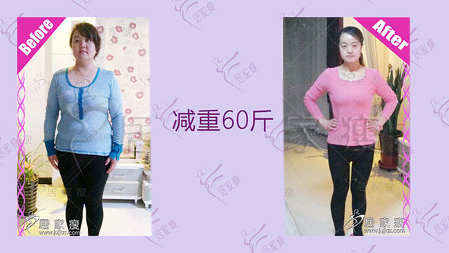 宁夏杨小姐在居家瘦成功减重60斤