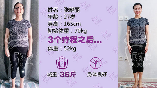 张晓丽在居家瘦成功减重36斤