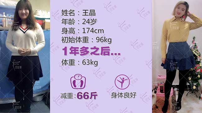 王晶小仙女在居家瘦成功减重66斤