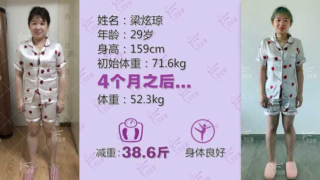 梁炫琼小仙女在居家瘦成功减重38.6斤